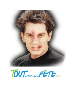 Cicatrice nez cassé avec colle adhésif 2