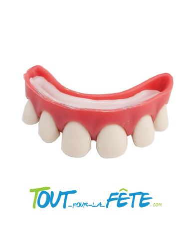 Dentier dents écartées ( avec pâte thermo - plastique )