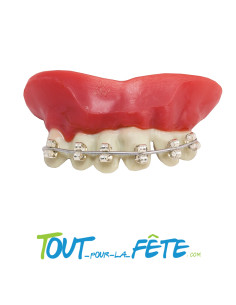 Dentier avec appareil dentaire fournis avec pâte thermo-plastique